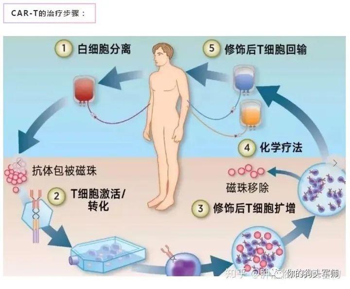 癌症治疗的新进展,癌症治疗的新进展，希望之光照亮前行的路