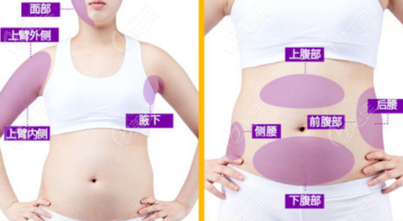 友情与陪伴的奇妙旅程中的抽脂隆胸价格探讨