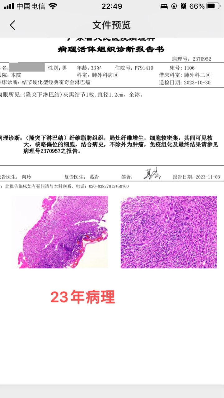 疫情最新病理探讨与解析