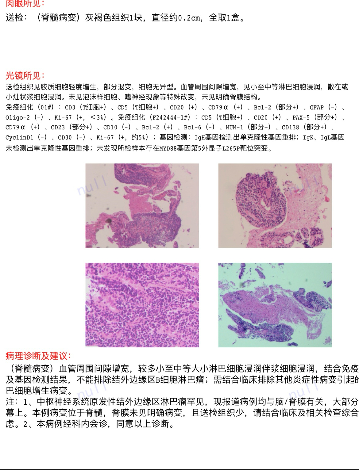 疫情最新病理探讨与解析