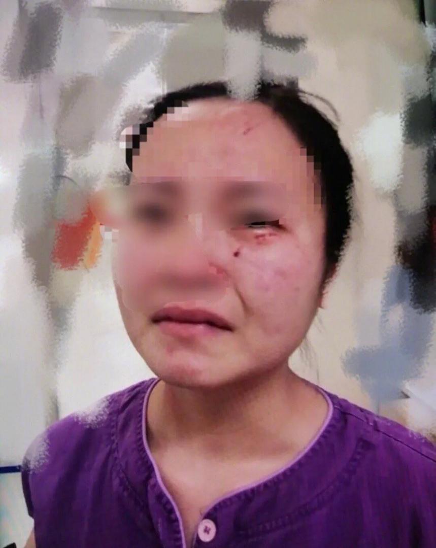 巷弄深处独特小吃秘境，揭秘黑人咬伤最新美食潮流