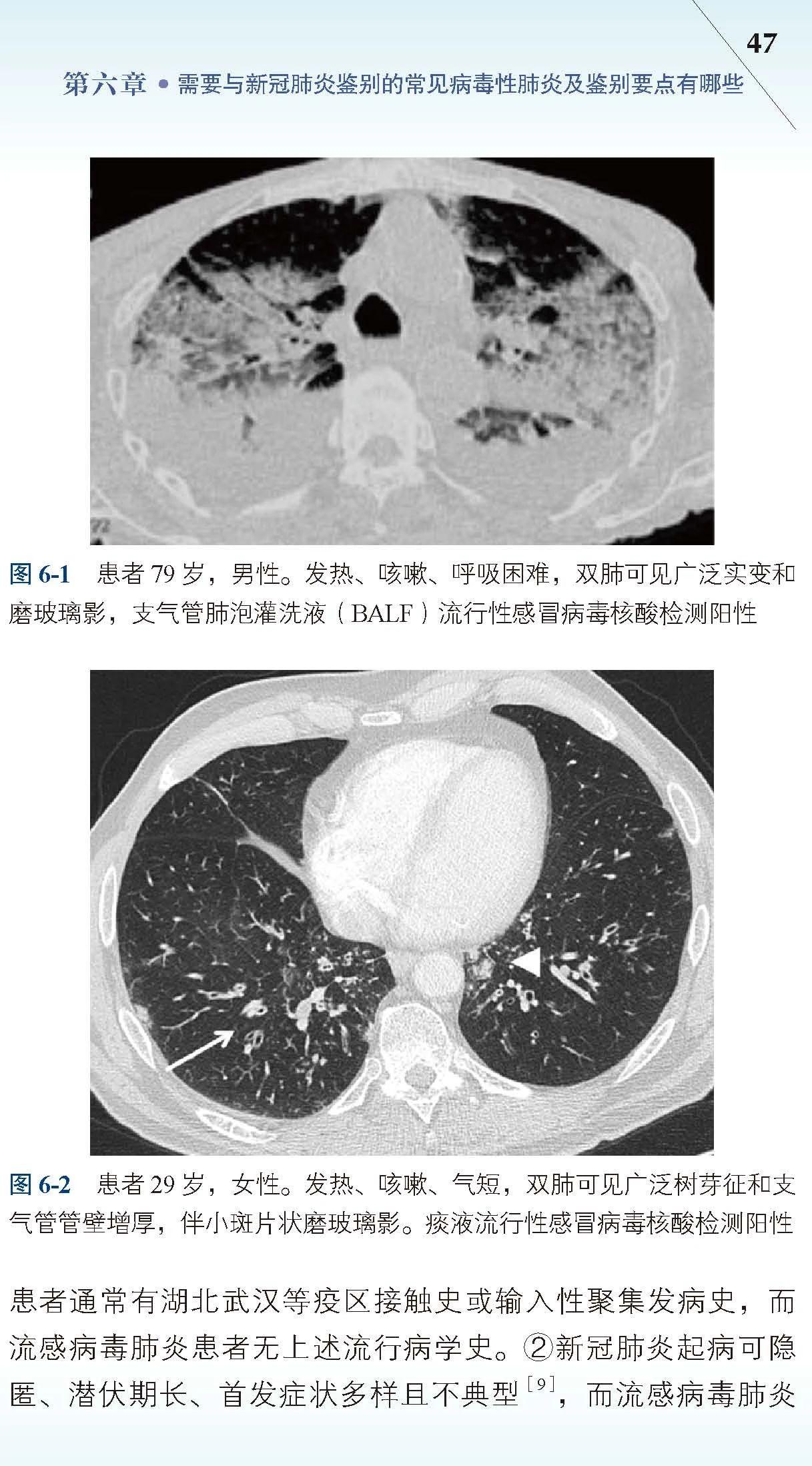 最新肺炎动态下的学习之旅，自信与力量的赋予之路