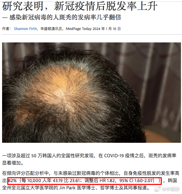 脱发最新研究，重塑自信与成就感的探索之旅
